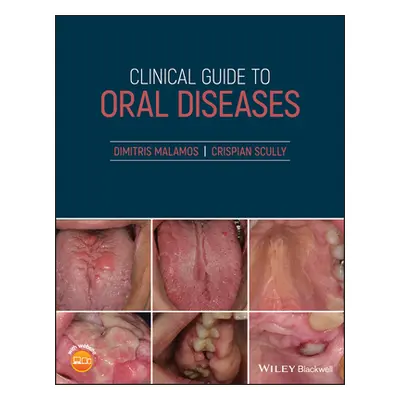 "Clinical Guide to Oral Diseases" - "" ("Malamos Dimitris")(Paperback)