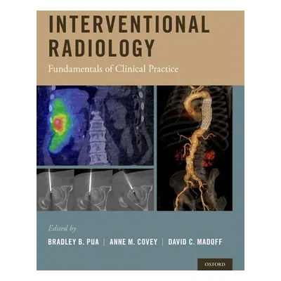 "Interventional Radiology: Fundamentals of Clinical Practice" - "" ("Pua Bradley B.")(Pevná vazb