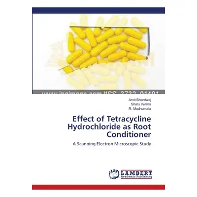 "Effect of Tetracycline Hydrochloride as Root Conditioner" - "" ("Bhardwaj Amit")(Paperback)