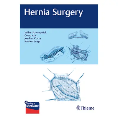 "Hernia Surgery" - "" ("Schumpelick Volker")(Pevná vazba)