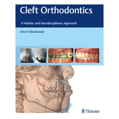 "Cleft Orthodontics: A Holistic and Interdisciplinary Approach" - "" ("Kharbanda Om P.")(Pevná v