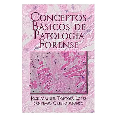 "Conceptos Basicos de Patologia Forense" - "" ("Lopez Jose Manuel Tortosa")(Paperback)