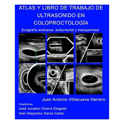 "Atlas y Libro de Trabajo de Ultrasonido en Coloproctologa" - "" ("Herrero Juan a. Villanueva")(