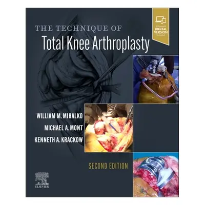 "The Technique of Total Knee Arthroplasty" - "" ("Mihalko William M.")(Pevná vazba)