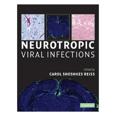 "Neurotropic Viral Infections" - "" ("")(Pevná vazba)