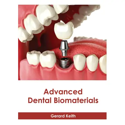 "Advanced Dental Biomaterials" - "" ("Keith Gerard")(Pevná vazba)