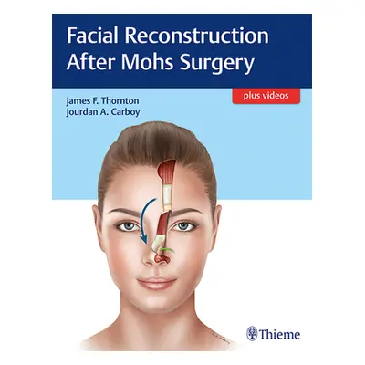 "Facial Reconstruction After Mohs Surgery" - "" ("Thornton James")(Pevná vazba)