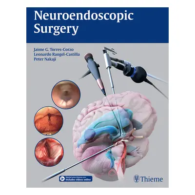 "Neuroendoscopic Surgery" - "" ("Torres-Corzo Jaime")(Pevná vazba)