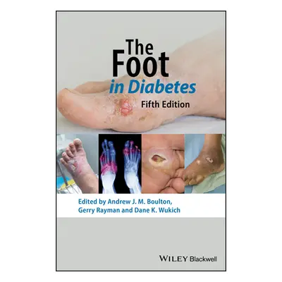 "The Foot in Diabetes" - "" ("Boulton Andrew J. M.")(Pevná vazba)