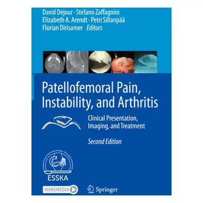 "Patellofemoral Pain, Instability, and Arthritis: Clinical Presentation, Imaging, and Treatment"