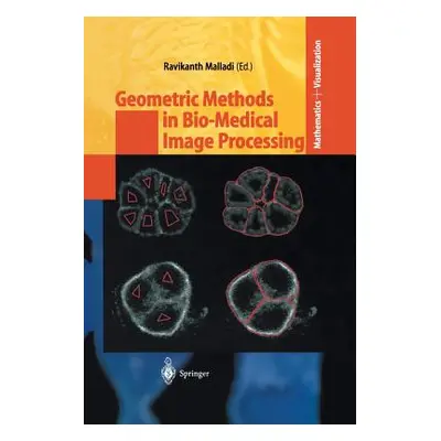 "Geometric Methods in Bio-Medical Image Processing" - "" ("Malladi Ravikanth")(Paperback)