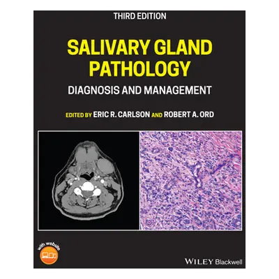 "Salivary Gland Pathology: Diagnosis and Management" - "" ("Carlson Eric R.")(Pevná vazba)