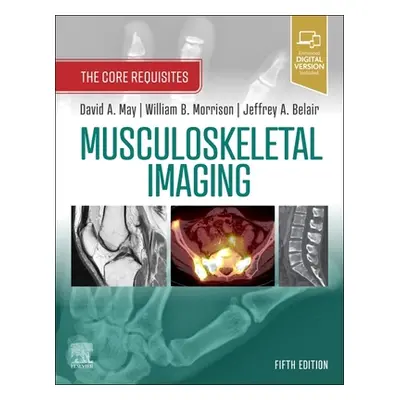 "Musculoskeletal Imaging: The Core Requisites" - "" ("May David A.")(Paperback)