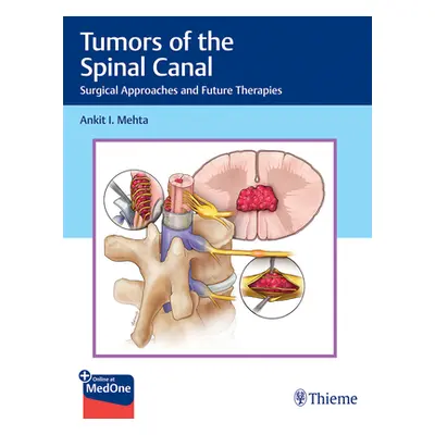 "Tumors of the Spinal Canal: Surgical Approaches and Future Therapies" - "" ("Mehta Ankit I.")(P