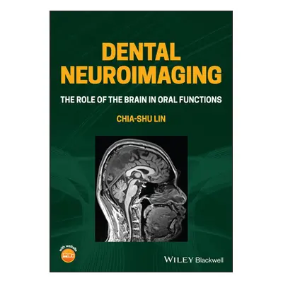 "Dental Neuroimaging: The Role of the Brain in Oral Functions" - "" ("Lin Chia-Shu")(Paperback)