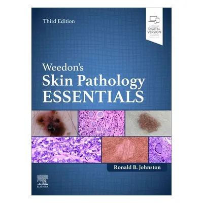 "Weedon's Skin Pathology Essentials" - "" ("Johnston Ronald")(Pevná vazba)