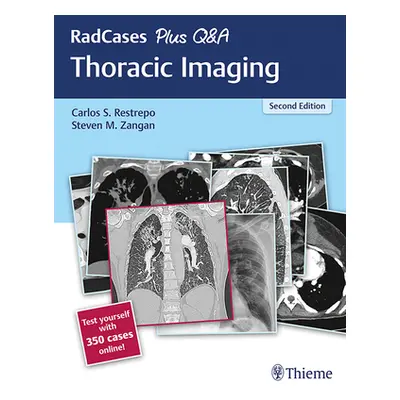 "Radcases Plus Q&A Thoracic Imaging" - "" ("Restrepo Carlos S.")(Paperback)