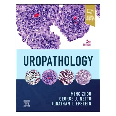 "Uropathology" - "" ("Zhou Ming")(Pevná vazba)