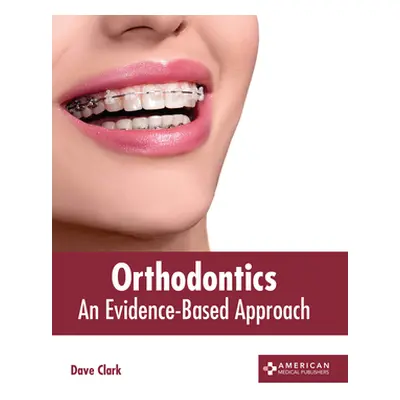 "Orthodontics: An Evidence-Based Approach" - "" ("Clark Dave")(Pevná vazba)