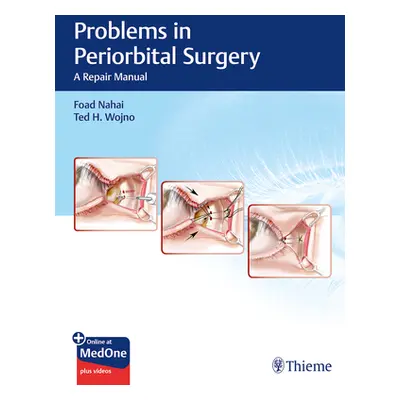 "Problems in Periorbital Surgery: A Repair Manual" - "" ("Nahai Foad")(Pevná vazba)