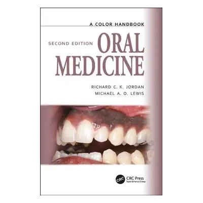 "Oral Medicine" - "" ("Lewis Michael")(Paperback)