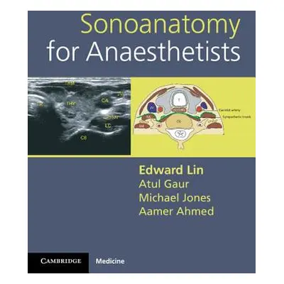 "Sonoanatomy for Anaesthetists" - "" ("Lin Edward")(Spiral)