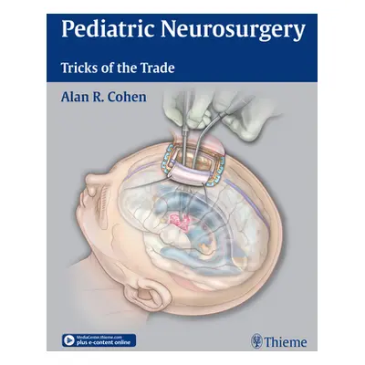 "Pediatric Neurosurgery: Tricks of the Trade" - "" ("Cohen Alan R.")(Pevná vazba)