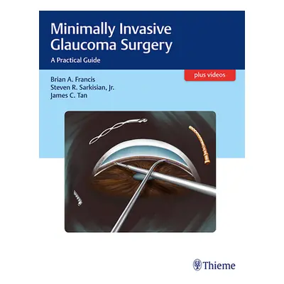 "Minimally Invasive Glaucoma Surgery: A Practical Guide" - "" ("Francis Brian")(Pevná vazba)