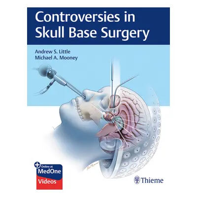 "Controversies in Skull Base Surgery" - "" ("Little Andrew S.")(Pevná vazba)