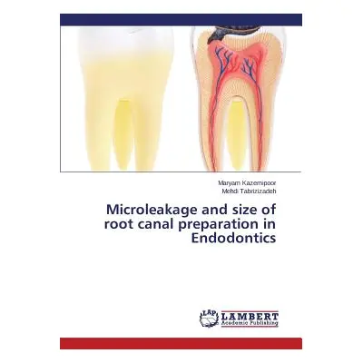 "Microleakage and size of root canal preparation in Endodontics" - "" ("Kazemipoor Maryam")(Pape