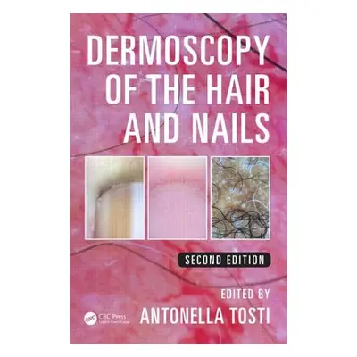 "Dermoscopy of the Hair and Nails" - "" ("Tosti Antonella")(Pevná vazba)