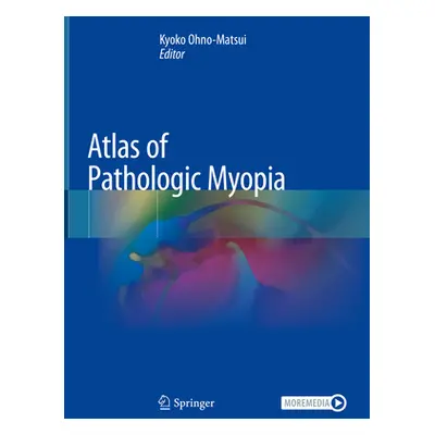 "Atlas of Pathologic Myopia" - "" ("Ohno-Matsui Kyoko")(Pevná vazba)