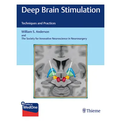 "Deep Brain Stimulation: Techniques and Practices" - "" ("Anderson William S.")(Pevná vazba)