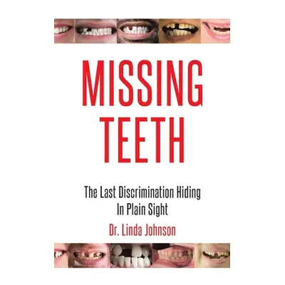 "Missing Teeth: The Last Discrimination Hiding in Plain Sight" - "" ("Johnson Linda")(Paperback)