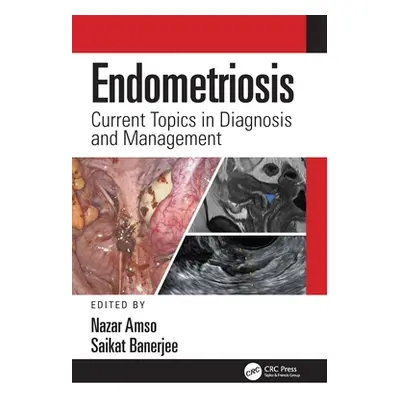 "Endometriosis: Current Topics in Diagnosis and Management" - "" ("Amso Nazar")(Pevná vazba)