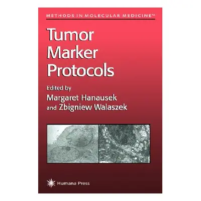 "Tumor Marker Protocols" - "" ("Hanausek Margaret")(Pevná vazba)