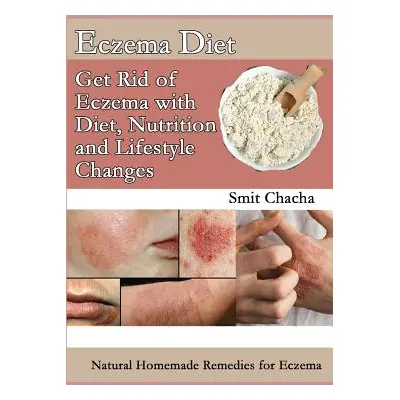 "Eczema Diet - Get Rid of Eczema with Diet, Nutrition and Lifestyle Changes: Natural Homemade Re