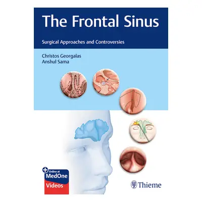 "The Frontal Sinus: Surgical Approaches and Controversies" - "" ("Georgalas Christos")(Pevná vaz