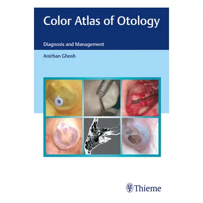 "Color Atlas of Otology: Diagnosis and Management" - "" ("Ghosh Anirban")(Pevná vazba)