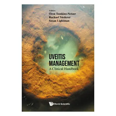 "Uveitis Management: A Clinical Handbook" - "" ("Tomkins-Netzer Oren")(Pevná vazba)