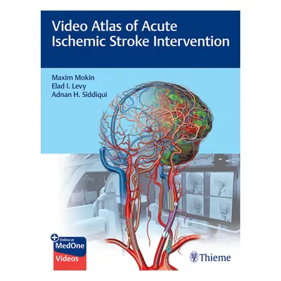 "Video Atlas of Acute Ischemic Stroke Intervention" - "" ("Mokin Maxim")(Pevná vazba)