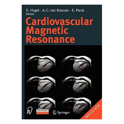 "Cardiovascular Magnetic Resonance [With CDROM]" - "" ("Nagel E.")(Paperback)