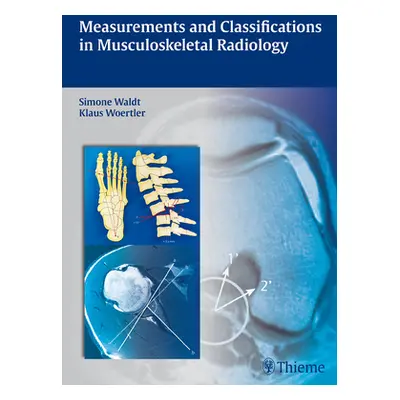 "Measurements and Classifications in Musculoskeletal Radiology" - "" ("Waldt Simone")(Pevná vazb