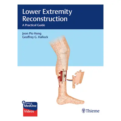 "Lower Extremity Reconstruction: A Practical Guide" - "" ("Hong Joon Pio")(Pevná vazba)