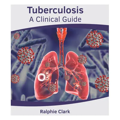 "Tuberculosis: A Clinical Guide" - "" ("Clark Ralphie")(Pevná vazba)