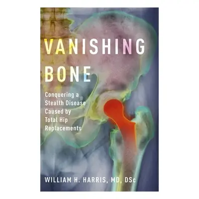 "Vanishing Bone: Conquering a Stealth Disease Caused by Total Hip Replacements" - "" ("Harris Wi