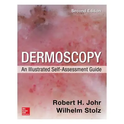 "Dermoscopy: An Illustrated Self-Assessment Guide, 2/E" - "" ("Johr Robert")(Paperback)