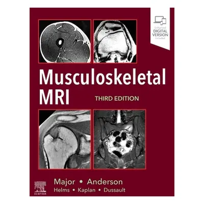 "Musculoskeletal MRI" - "" ("Major Nancy M.")(Pevná vazba)