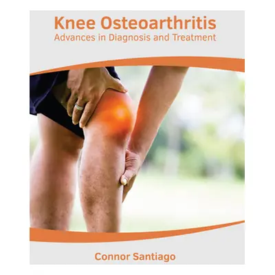 "Knee Osteoarthritis: Advances in Diagnosis and Treatment" - "" ("Santiago Connor")(Pevná vazba)