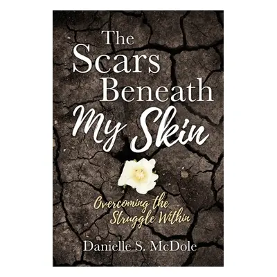 "The Scars Beneath My Skin: Overcoming the Struggle Within" - "" ("McDole Danielle S.")(Paperbac